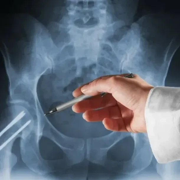Trauma doctor pointing at patient xray