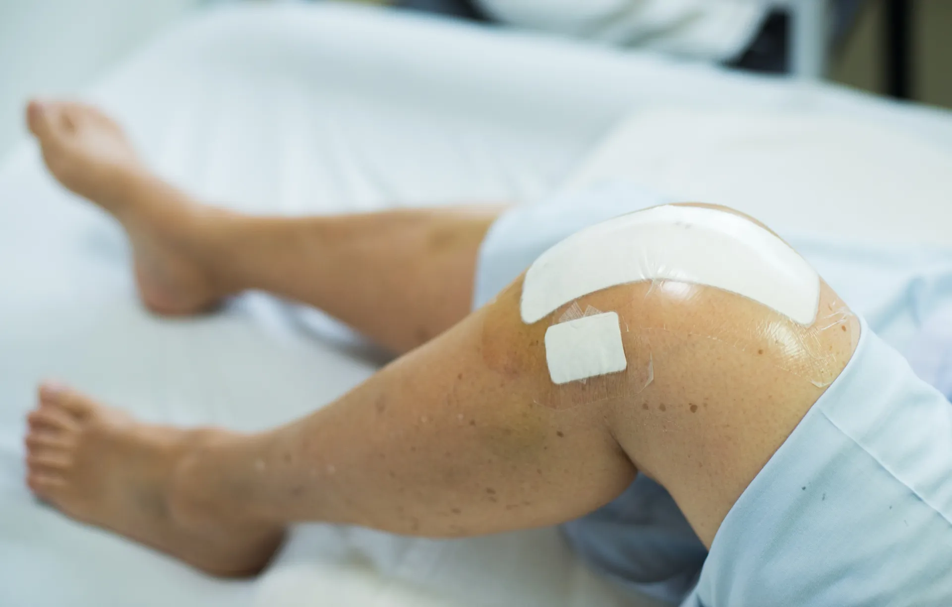 up-close of knee bandages from knee-replacement surgery